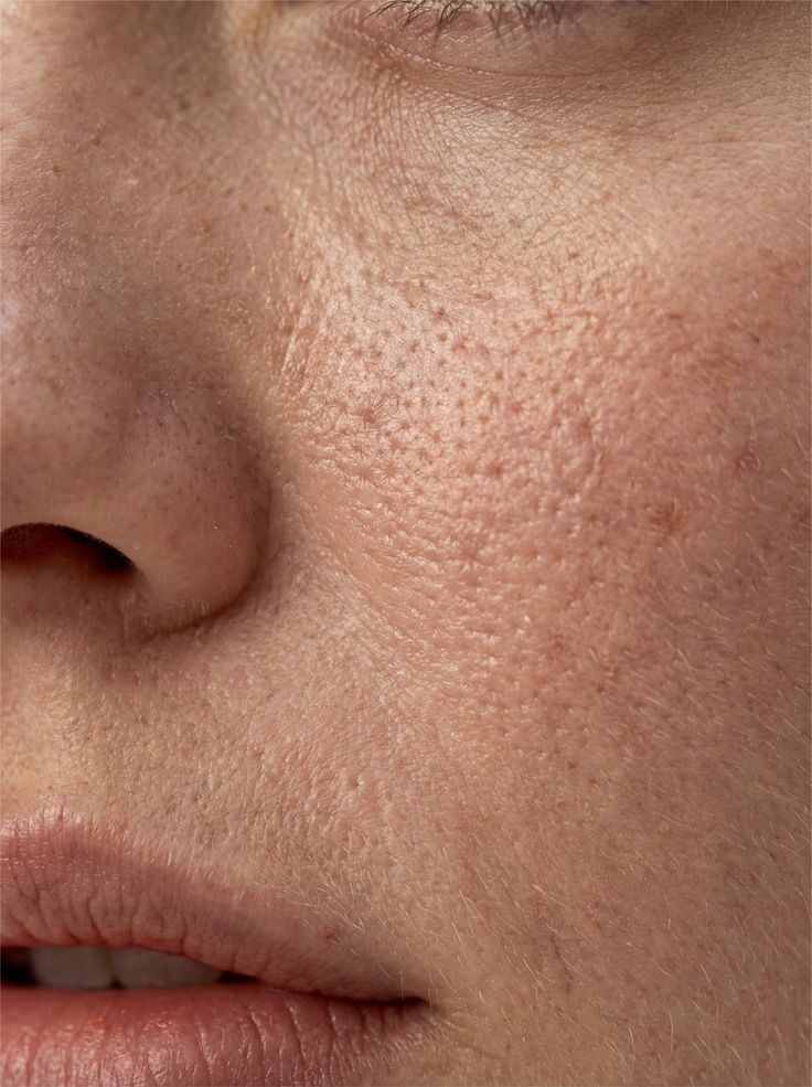 Terapia dérmica y estética regenerativa
